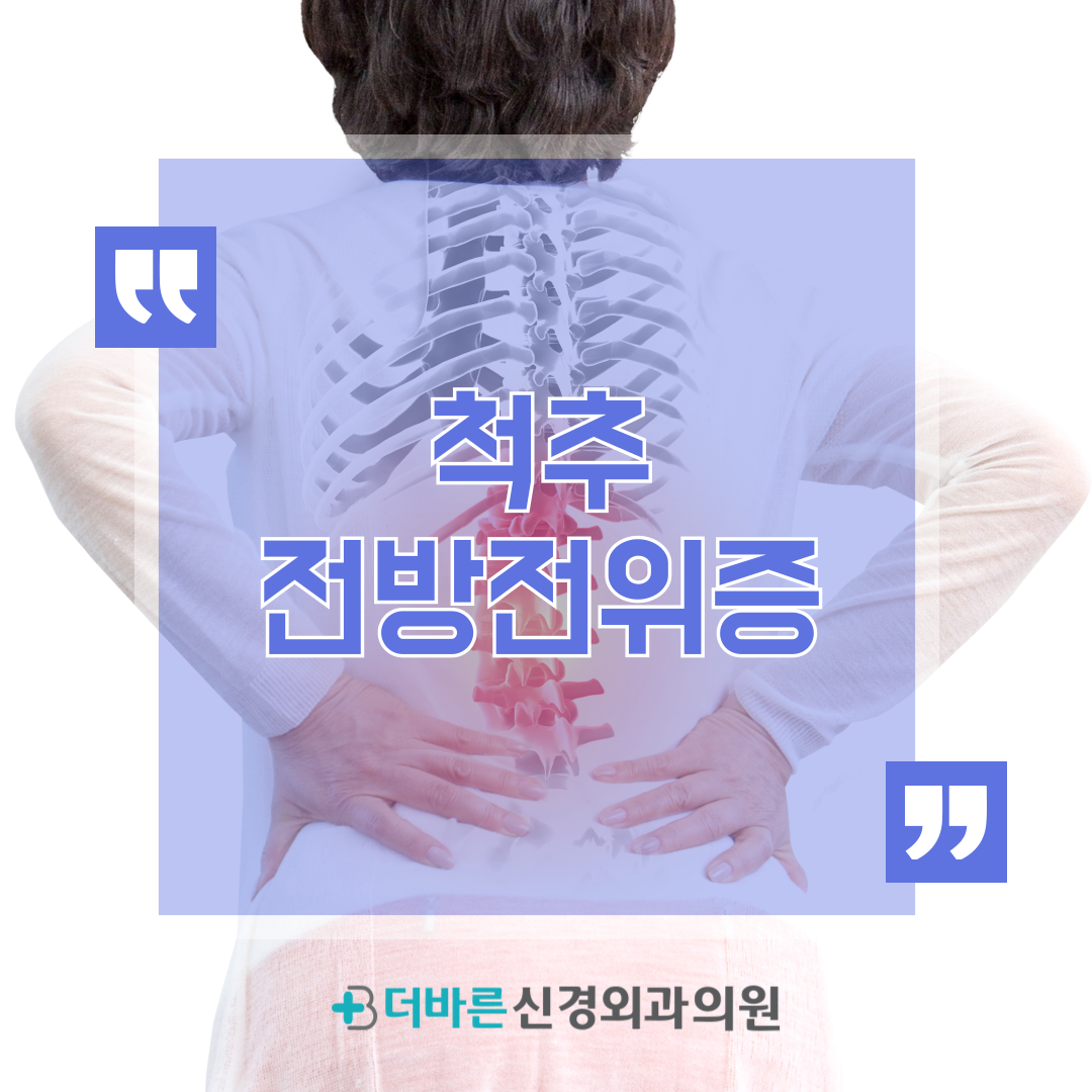 척추전방전위증이 중년 여성에게 흔한 이유는? 사진