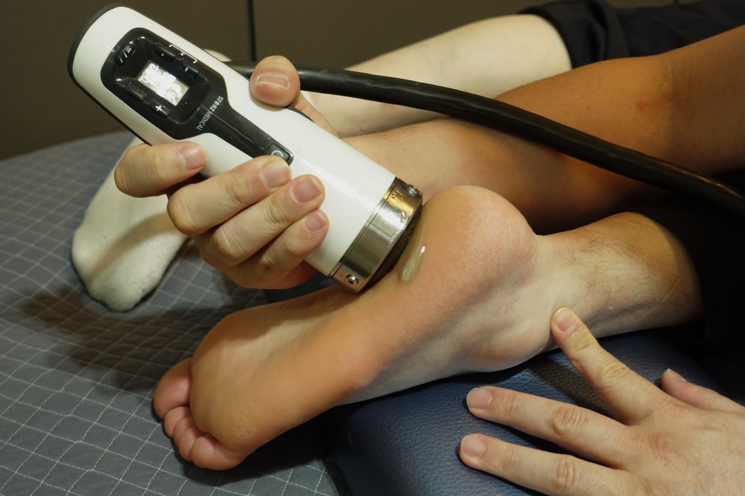 족저근막염 통증 체외충격파로 치료하세요! 사진