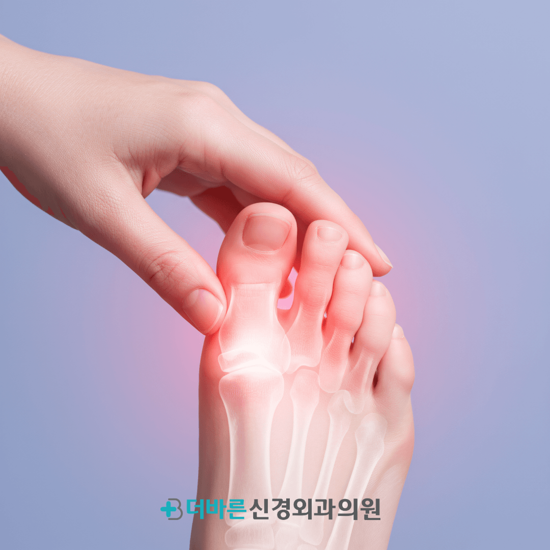 향남정형외과추천, 무지외반증 초기 증상과 예방법 알아보기 사진