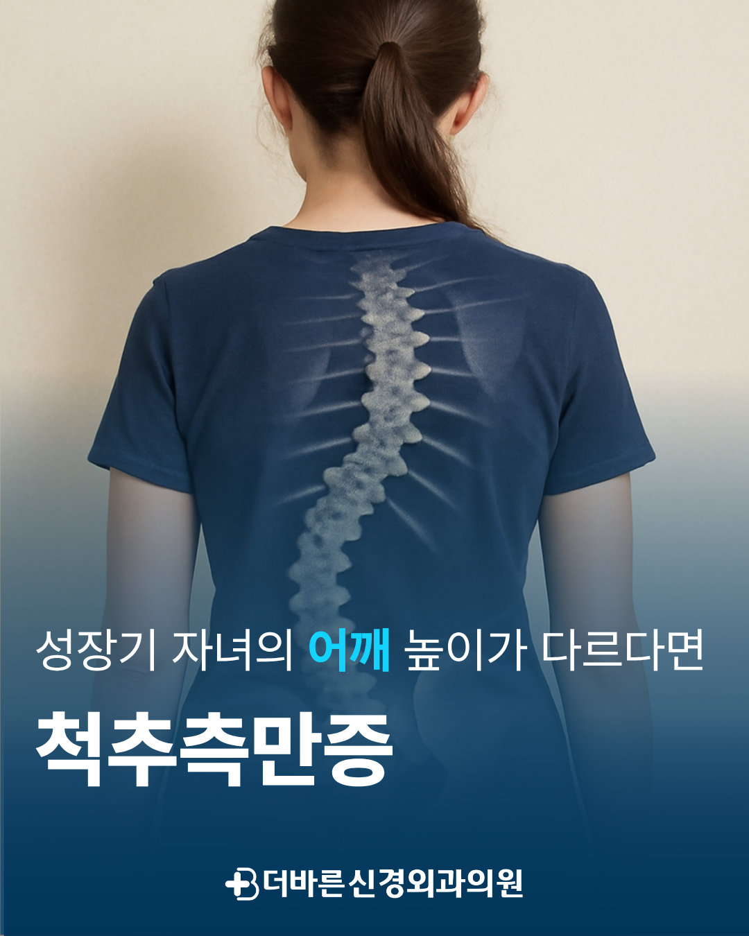 향남신경외과 - 성장기 자녀의 어깨 높이가 다르다면?
