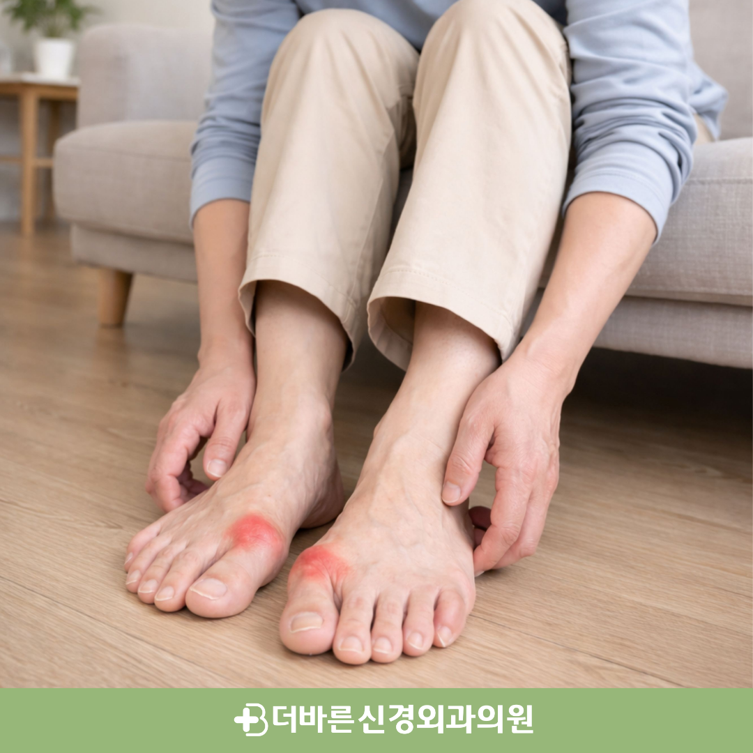 향남1지구정형외과 - 엄지발가락이 휘어지는 무지외반증, 치료는?